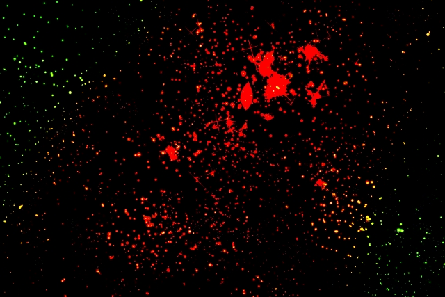 歯磨きをすると血が出てくる!考えられる7つの原因と治療法 歯磨きをすると血が出てくる!考えられる7つの原因と治療法